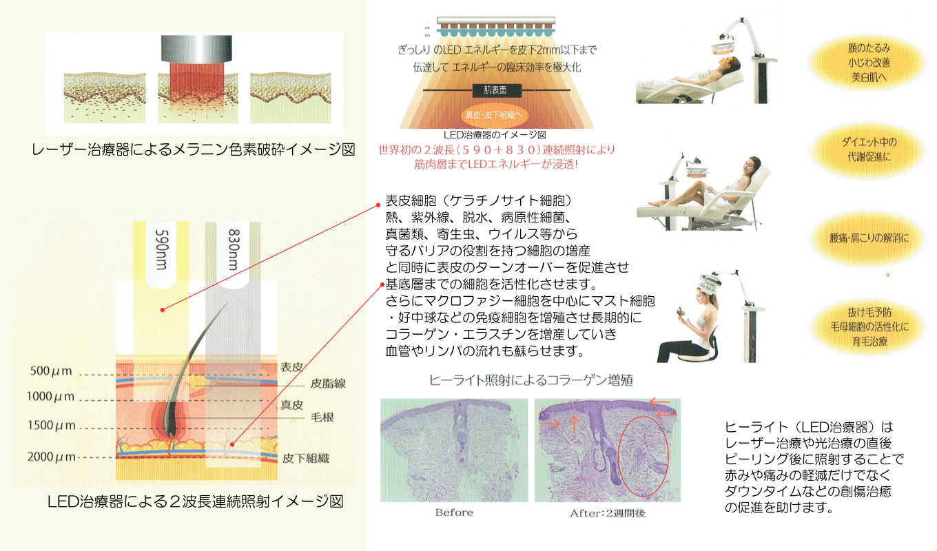 使用治療器の機能説明